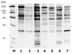 0.2μg/ml (Prod. No. ALX-804-172) 5: Clone 9H8