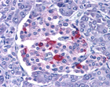 EndoG polyclonal antibody Immunohistochemistry