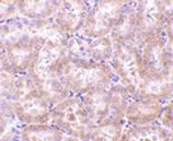 RIP3 polyclonal antibody Immunohistochemistry