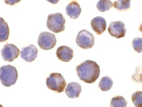 ADAM17 (CT) polyclonal antibody Immunocytochemistry