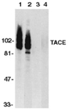 ADAM17 (CT) polyclonal antibody Western blot