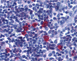 BAFF receptor (CT) BR3 polyclonal antibody Immunohistochemistry