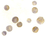 TACI polyclonal antibody Immunocytochemistry