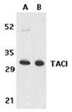 TACI polyclonal antibody Western blot
