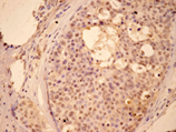 Bad monoclonal antibody (5E6) Immunohistochemistry
