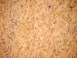 Insulin receptor monoclonal antibody (9H4) Immunohistochemistry