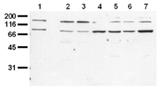 Insulin receptor monoclonal antibody (9H4) Western blot