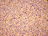 Jnk2 monoclonal antibody (12C5) Immunohistochemistry