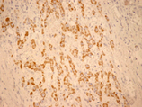 Jnk3 monoclonal antibody (4G6) Immunohistochemistry