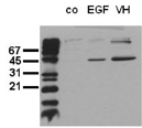 [pSer218/222]MEK1 and [pSer222/226]MEK2 monoclonal antibody (7E10) Western blot