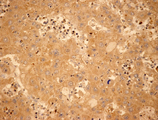 Shc monoclonal antibody (11F6) Immunohistochemistry