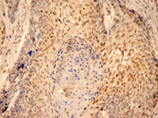 [pSer727]Stat3 monoclonal antibody (23G5) Immunohistochemistry