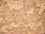 [pTyr695/Tyr699]Stat5 A/B monoclonal antibody (5G4) Immunohistochemistry
