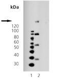 PDGF receptor β monoclonal antibody (42G12) Western blot