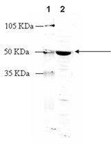 Cannabinoid receptor CB1 polyclonal antibody Western blot