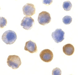 IRAK-1 polyclonal antibody Immunocytochemistry