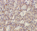 TLR2 polyclonal antibody Immunohistochemistry