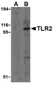 TLR2 polyclonal antibody Western blot