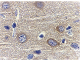 Adiponectin polyclonal antibody Immunohistochemistry