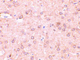 Beclin-1 polyclonal antibody Immunohistochemistry