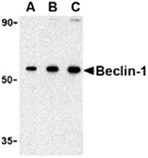 Beclin-1 polyclonal antibody Western blot