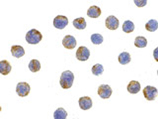 LAMP2 polyclonal antibody Immunocytochemistry