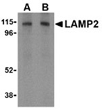 LAMP2 polyclonal antibody Western blot