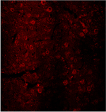 Dopamine receptor D2 polyclonal antibody Immunohistochemistry