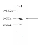 Dopamine receptor D2 polyclonal antibody Western blot