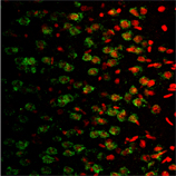 Serotonin receptor 5HT1A polyclonal antibody Immunohistochemistry