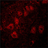 Adrenergic receptor β2 polyclonal antibody Immunohistochemistry