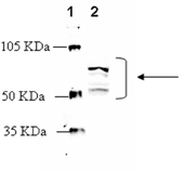 Adrenergic receptor β2 polyclonal antibody Western blot