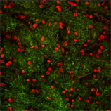 Angiotensin II receptor AT1 polyclonal antibody Immunohistochemistry