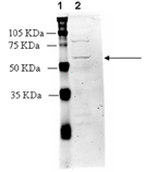 Angiotensin II receptor AT1 polyclonal antibody Western blot