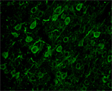 Bradykinin receptor B2 polyclonal antibody Immunohistochemistry