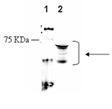 Bradykinin receptor B2 polyclonal antibody Western blot