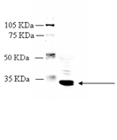 Cannabinoid receptor CB2 polyclonal antibody Western blot