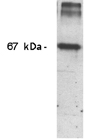 Nitrotyrosine monoclonal antibody (7A5) Western blot