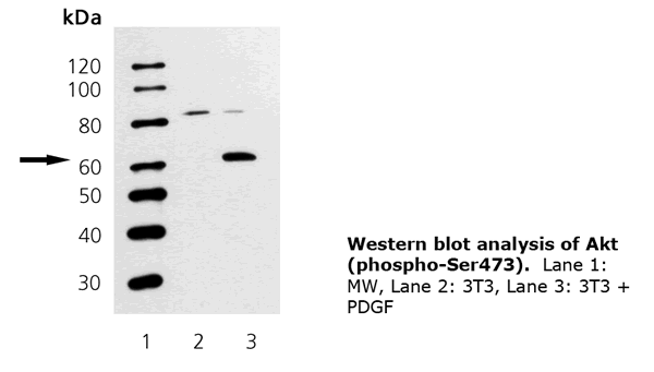 [pSer473]Akt polyclonal antibody Western Blot