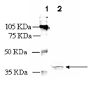 Bradykinin receptor B1 polyclonal antibody Western blot