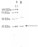 LTB4 receptor (BLT1) polyclonal antibody Western blot