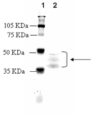 Opioid receptor κ polyclonal antibody Western blot
