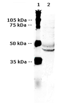 Vasopressin receptor V2 polyclonal antibody Western blot