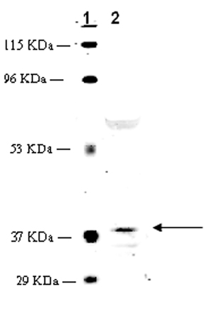 GPR55 polyclonal antibody Western blot