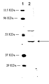 PGF2α receptor (FP) polyclonal antibody Western blot