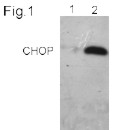 Presenilin 1 monoclonal antibody (APS 11) Immunocytochemistry