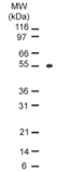 Osteoprotegerin monoclonal antibody (98A1071) Western blot