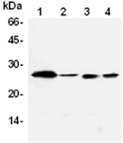 Bcl-2 monoclonal antibody (83-8B) Western blot