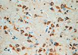 Bax monoclonal antibody (4F11) Immunohistochemistry