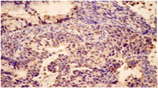 Bak polyclonal antibody Immunohistochemistry